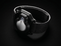 Resolve Band — Armband for Medtronic Guardian CGM